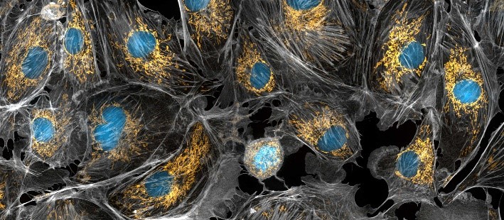 Many blue circles, each surrounded by yellow dots. All the structures are encased in gray webs.