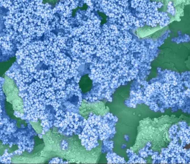 Large clumps of blue, spherical bacteria on a rough, green surface.